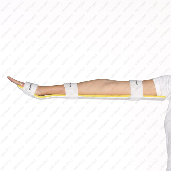 Long Arm Splint